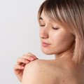 Zbavte sa jaziev po akné: Tipy od dermatológov a overené domáce recepty